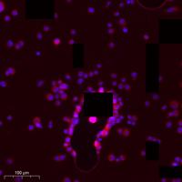UMP-CMP Kinase Polyclonal Antibody