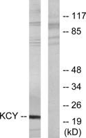 UMP-CMP Kinase Polyclonal Antibody