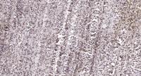UMP-CMP Kinase Polyclonal Antibody