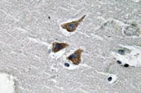 uPA Polyclonal Antibody