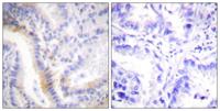 Urocortin Polyclonal Antibody