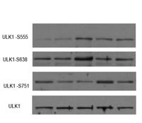 ULK1 Polyclonal Antibody