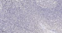 ULK1 Polyclonal Antibody