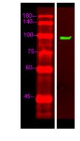 UNC5C Polyclonal Antibody