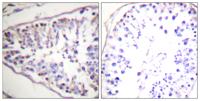 HSL Polyclonal Antibody