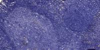 OPN Polyclonal Antibody