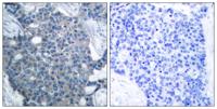 Op18 Polyclonal Antibody