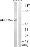 Oncogene TIM Polyclonal Antibody