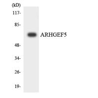 Oncogene TIM Polyclonal Antibody