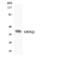 Olfactory receptor 9Q2 Polyclonal Antibody