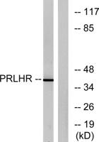 GPR10 Polyclonal Antibody