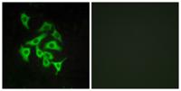 GPR100 Polyclonal Antibody