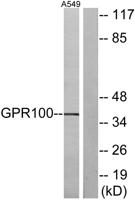 GPR100 Polyclonal Antibody
