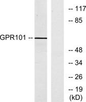GPR101 Polyclonal Antibody