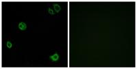 GPR110 Polyclonal Antibody
