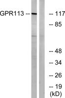 GPR113 Polyclonal Antibody