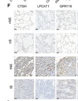 GPR116 Polyclonal Antibody
