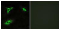 GPR116 Polyclonal Antibody