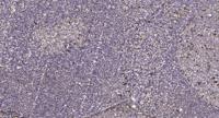 GPR116 Polyclonal Antibody