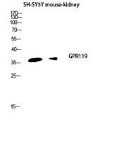 GPR119 Polyclonal Antibody