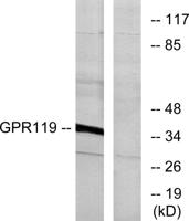 GPR119 Polyclonal Antibody