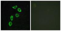 GPR123 Polyclonal Antibody