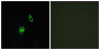 GPR124 Polyclonal Antibody