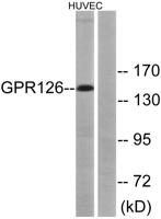 GPR126 Polyclonal Antibody