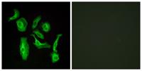 GPR133 Polyclonal Antibody