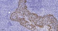 GPR135 Polyclonal Antibody