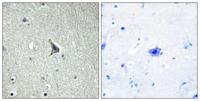 GPR137C Polyclonal Antibody