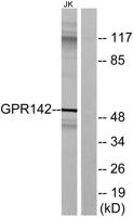 GPR142 Polyclonal Antibody