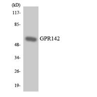 GPR142 Polyclonal Antibody