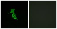 GPR143 Polyclonal Antibody