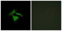 GPR149 Polyclonal Antibody