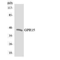 GPR15 Polyclonal Antibody