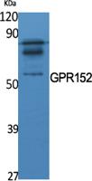 GPR152 Polyclonal Antibody