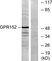 GPR152 Polyclonal Antibody