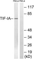 Rrn3 Polyclonal Antibody