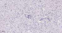 Rrn3 Polyclonal Antibody