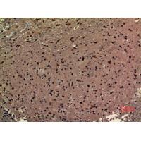 RRP7A Polyclonal Antibody