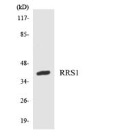 RRS1 Polyclonal Antibody