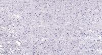 RRS1 Polyclonal Antibody
