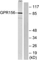 GPR156 Polyclonal Antibody