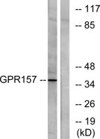 GPR157 Polyclonal Antibody