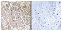 ACAD-10 Polyclonal Antibody