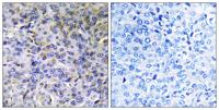 ACAD-11 Polyclonal Antibody