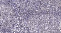 ACAD-9 Polyclonal Antibody