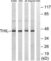 ACAT-1 Polyclonal Antibody