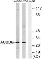 ACBD6 Polyclonal Antibody